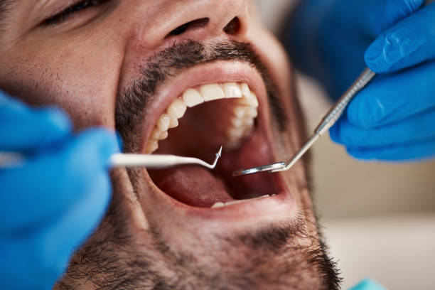 Emergency Dental Services in Idalou, TX